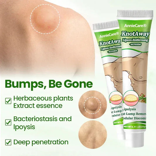โฐLast Day Promotion: 60% OFF๐ฅAnnieCareยฎ KnotAway Lipoma Removal Cream