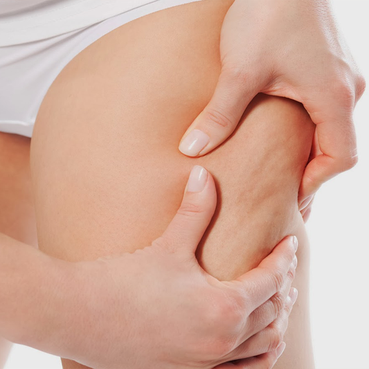 Natural Skin Tightening Body Spray