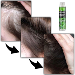 HairReBirth Herbal Spray