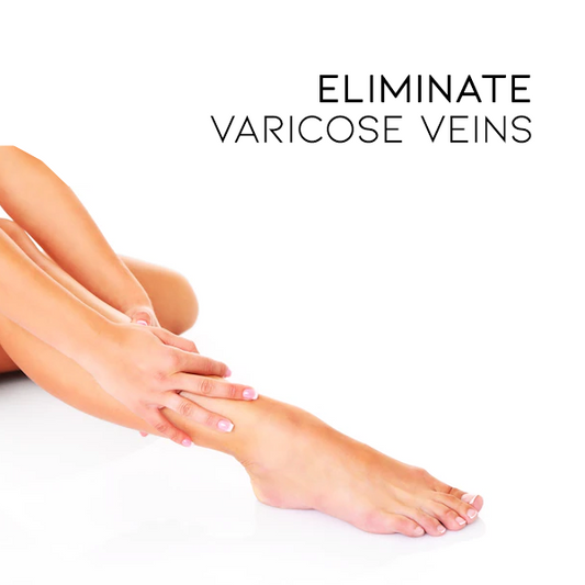 Varicose Veins Miracle Cream