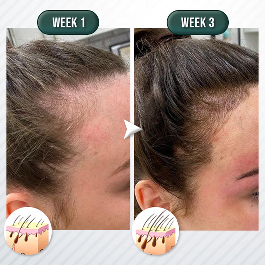 Instant Hair Regrowth Centella Scrub