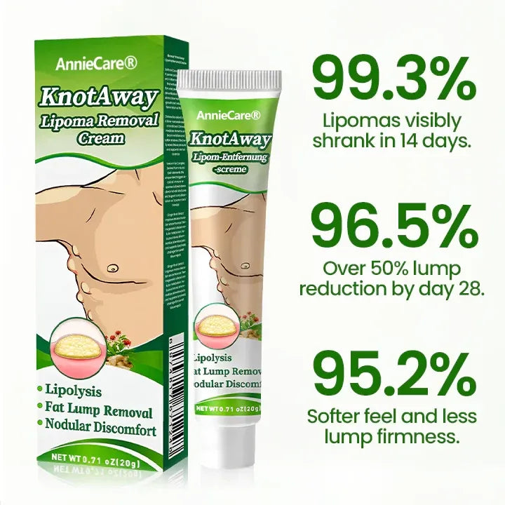 ⏰Last Day Promotion: 60% OFF🔥AnnieCare® KnotAway Lipoma Removal Cream