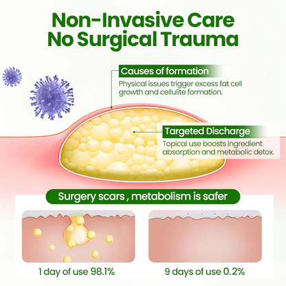 ⏰Last Day Promotion: 60% OFF🔥AnnieCare® KnotAway Lipoma Removal Cream