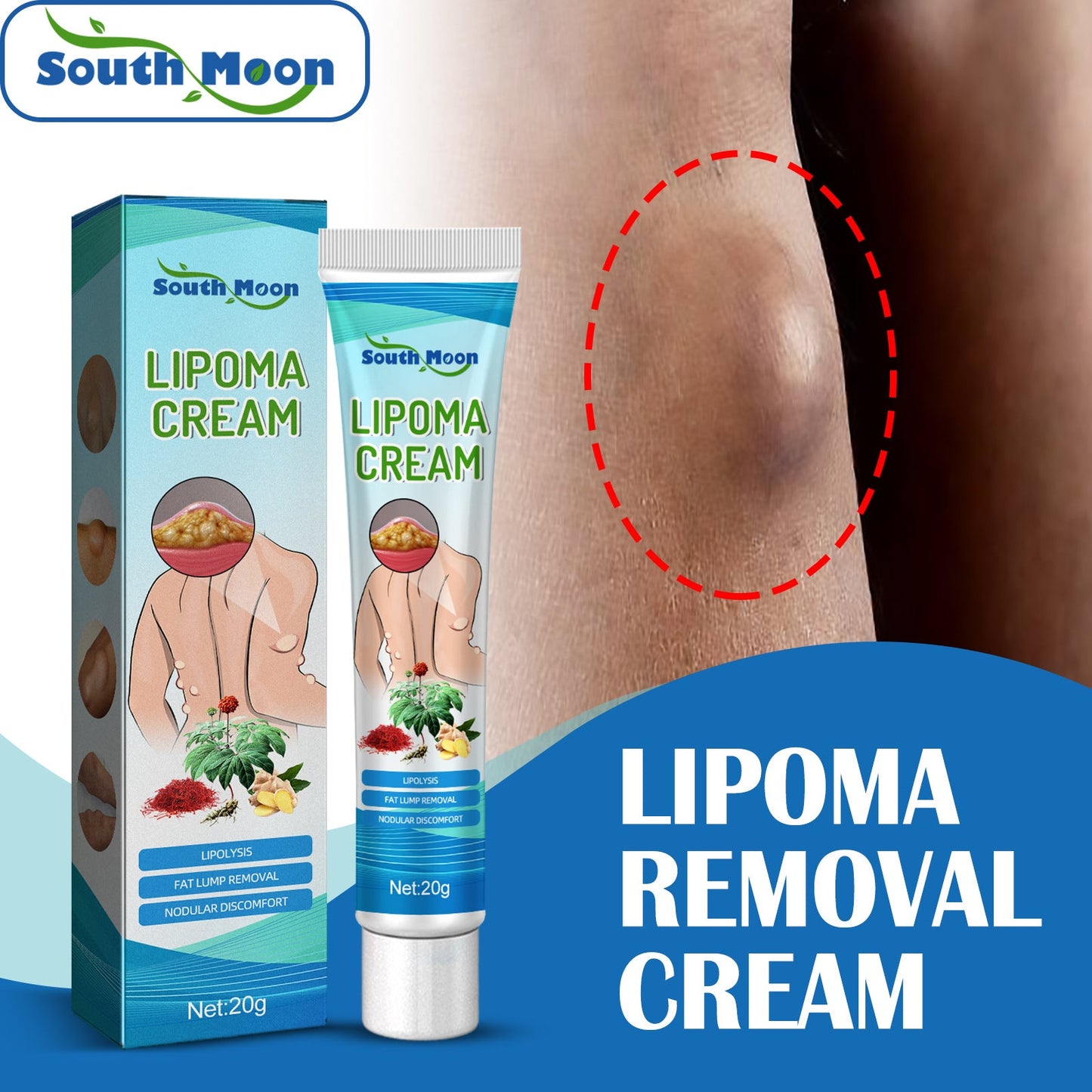 South Moon Lipoma Removal Cream