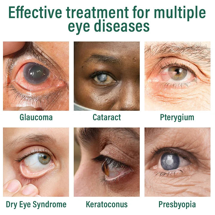 AnnieCare® Nano Eye Drops Serum ✅FDA Approved(Suitable for presbyopia, dry eye syndrome, glaucoma, and cataracts)