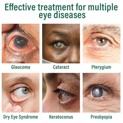 AnnieCare® Nano Eye Drops Serum ✅FDA Approved(Suitable for presbyopia, dry eye syndrome, glaucoma, and cataracts)