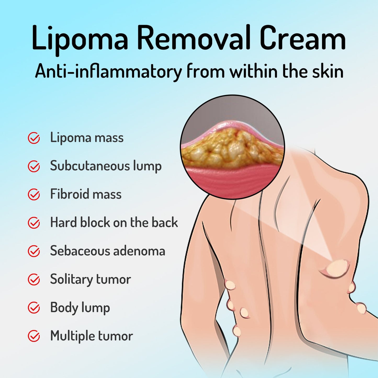 South Moon Lipoma Removal Cream