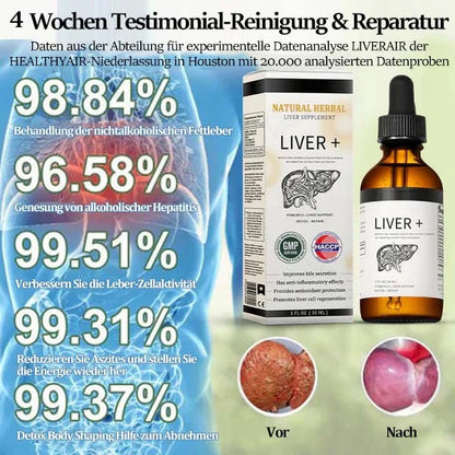AnnieCare® Natürliches Leber-Kräuterpräparat – Starke Leberunterstützung – Entgiftung & Regeneration – Unterstützt gesunde Blutzucker- und Blutfettwerte