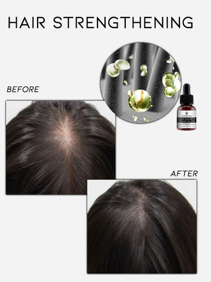 ArtisCare Hair Growth Essential Oil